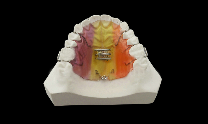 深圳义齿CAD/CAM技术和3D打印技术、透明牙套保持器