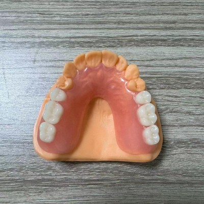 深圳定制式牙齿隐形正畸矫治器-3D隐形矫正-隐形牙套矫治